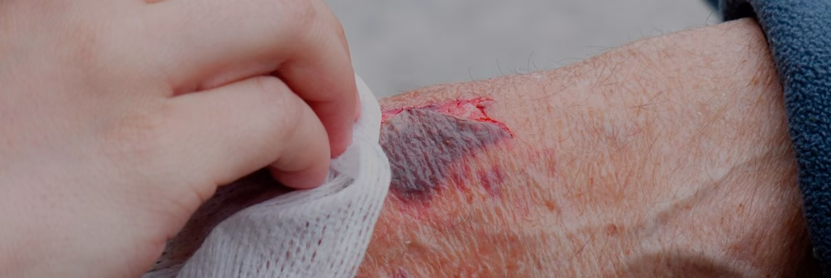 O que é Tetanospasmina e para que serve?