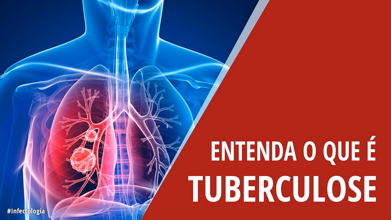 O que é a tuberculose?