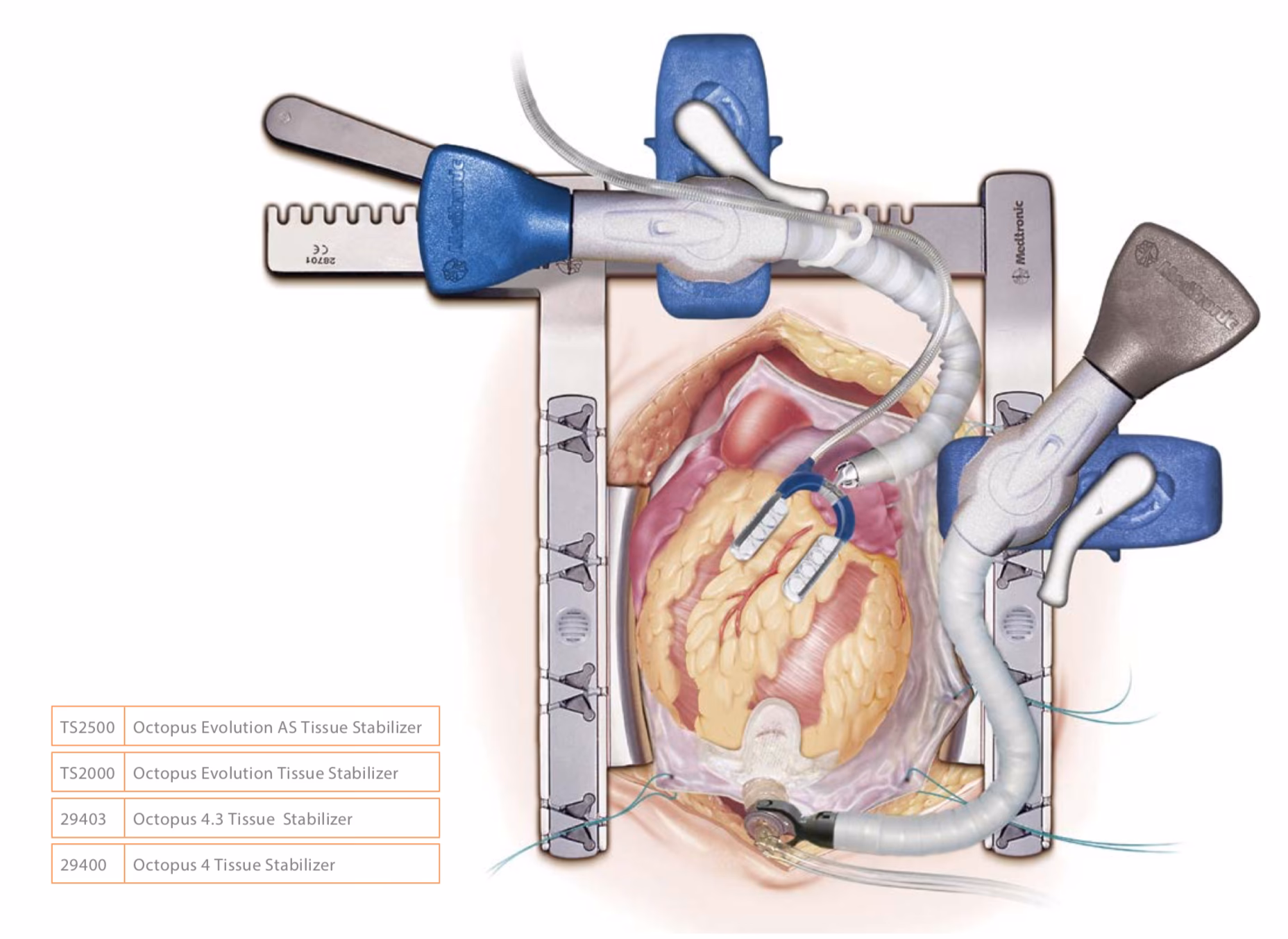 How does OPCAB work?