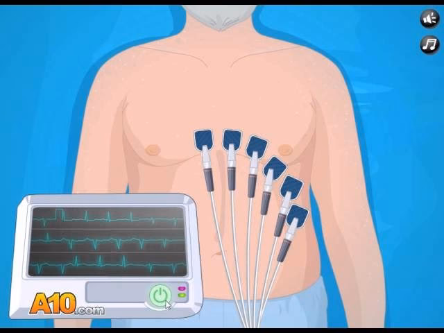 Can a node start a Pacemaker service?