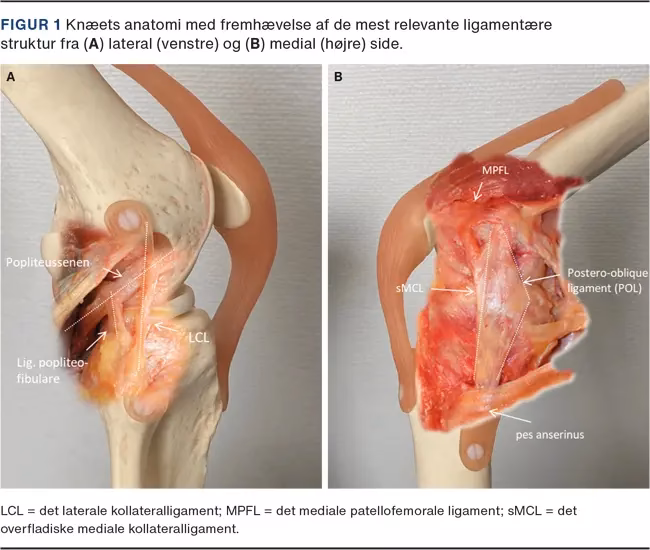 Kan en bursitis ramme alle?