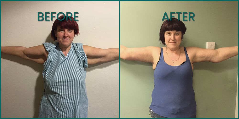 How do I get rid of bingo wings?