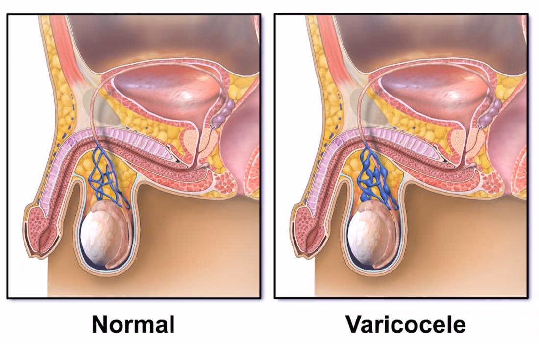 How long does it take for low sperm count?