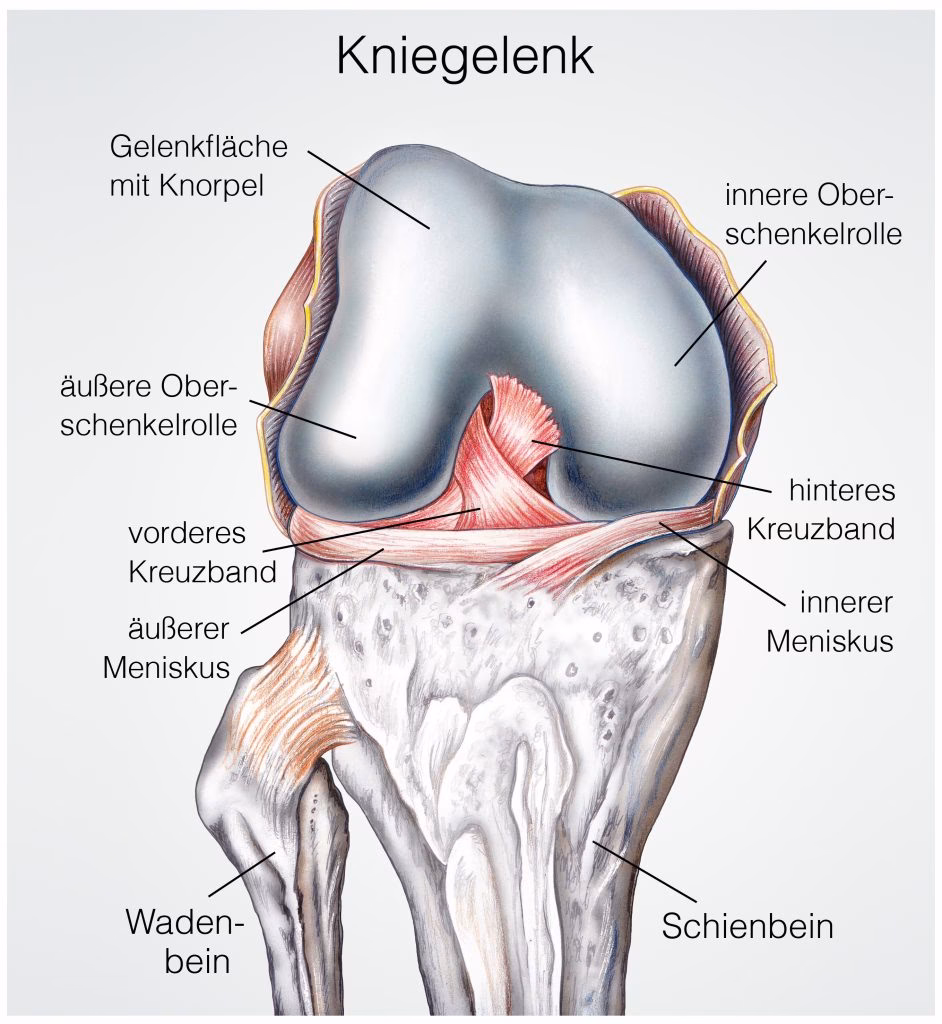 Was tun nach einer Meniskusoperation?