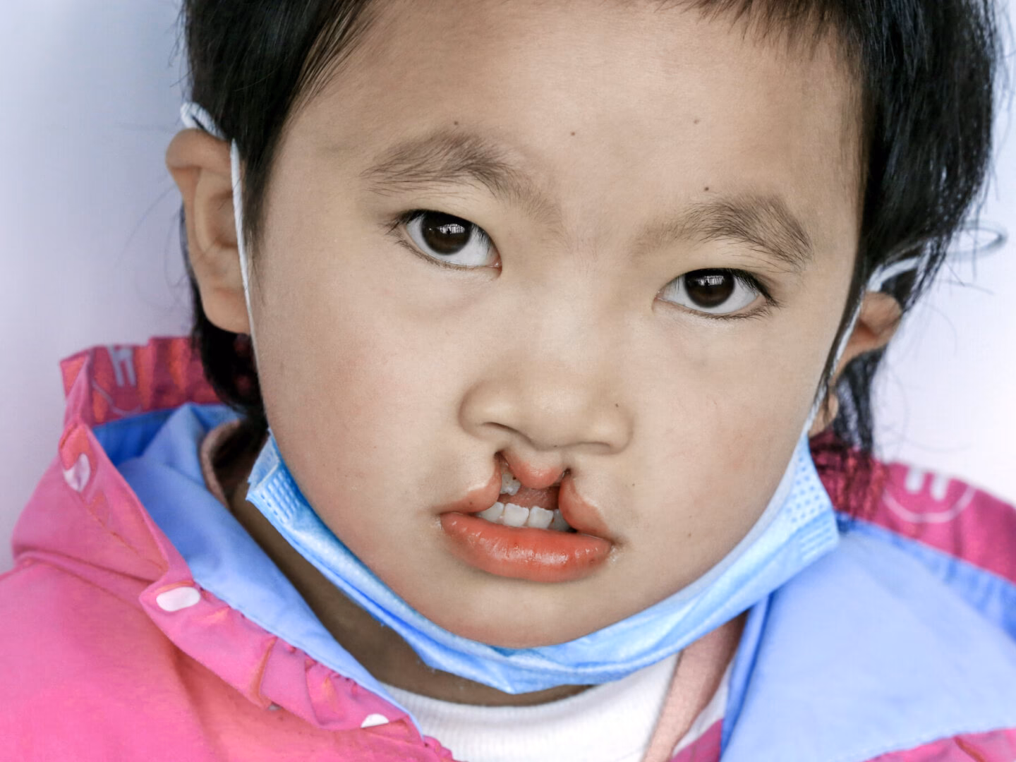 Who is Operation Smile?