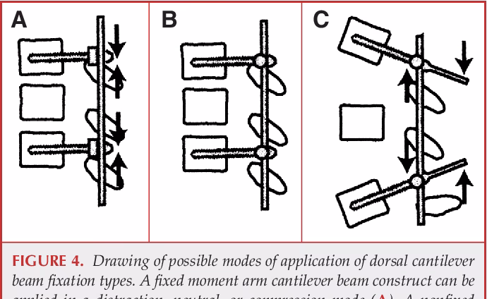 What is the cantilever bending technique?