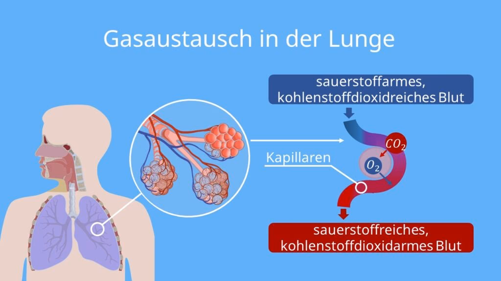 Was ist eine Operation an der Lunge?