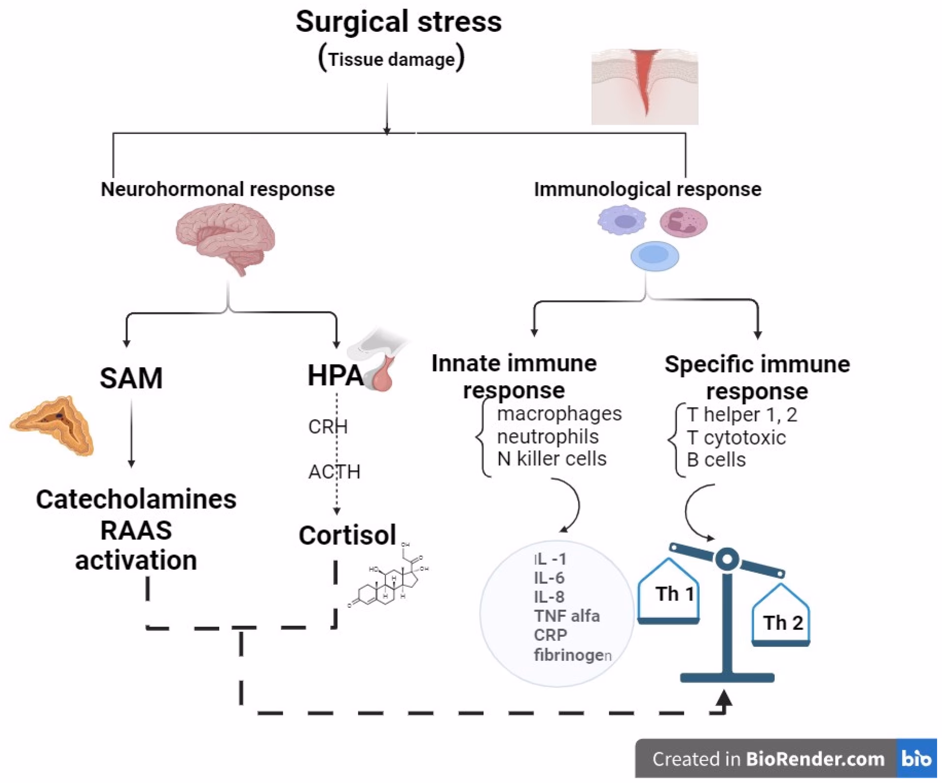 How can I cope with anxiety before surgery?