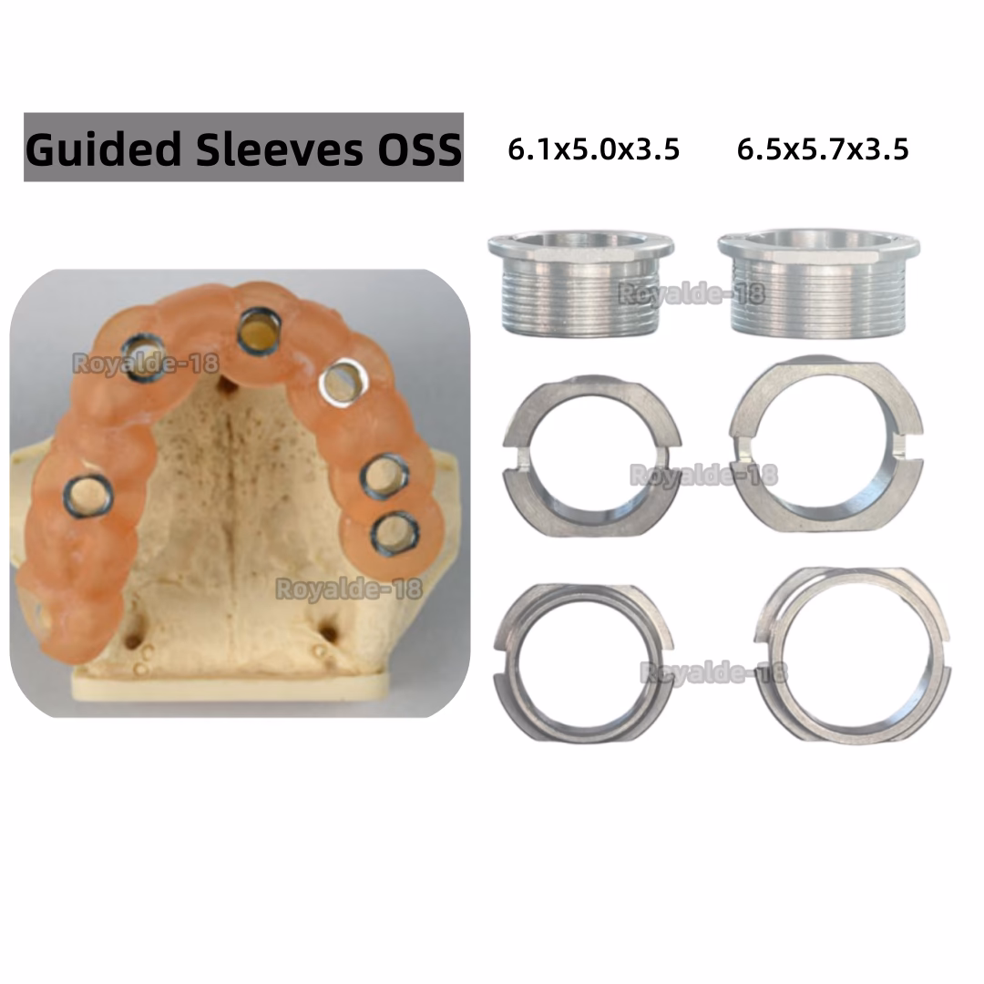 What is the army's view on the operations process?