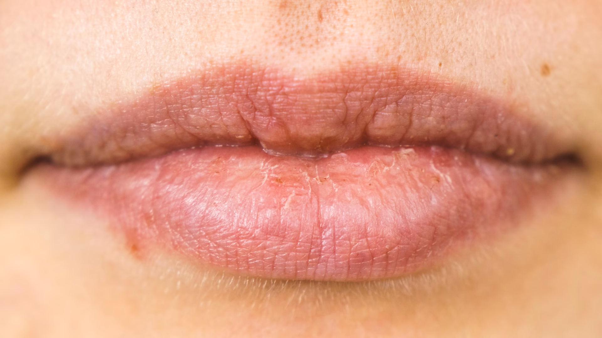 How do you know if you have a toothpaste allergy?
