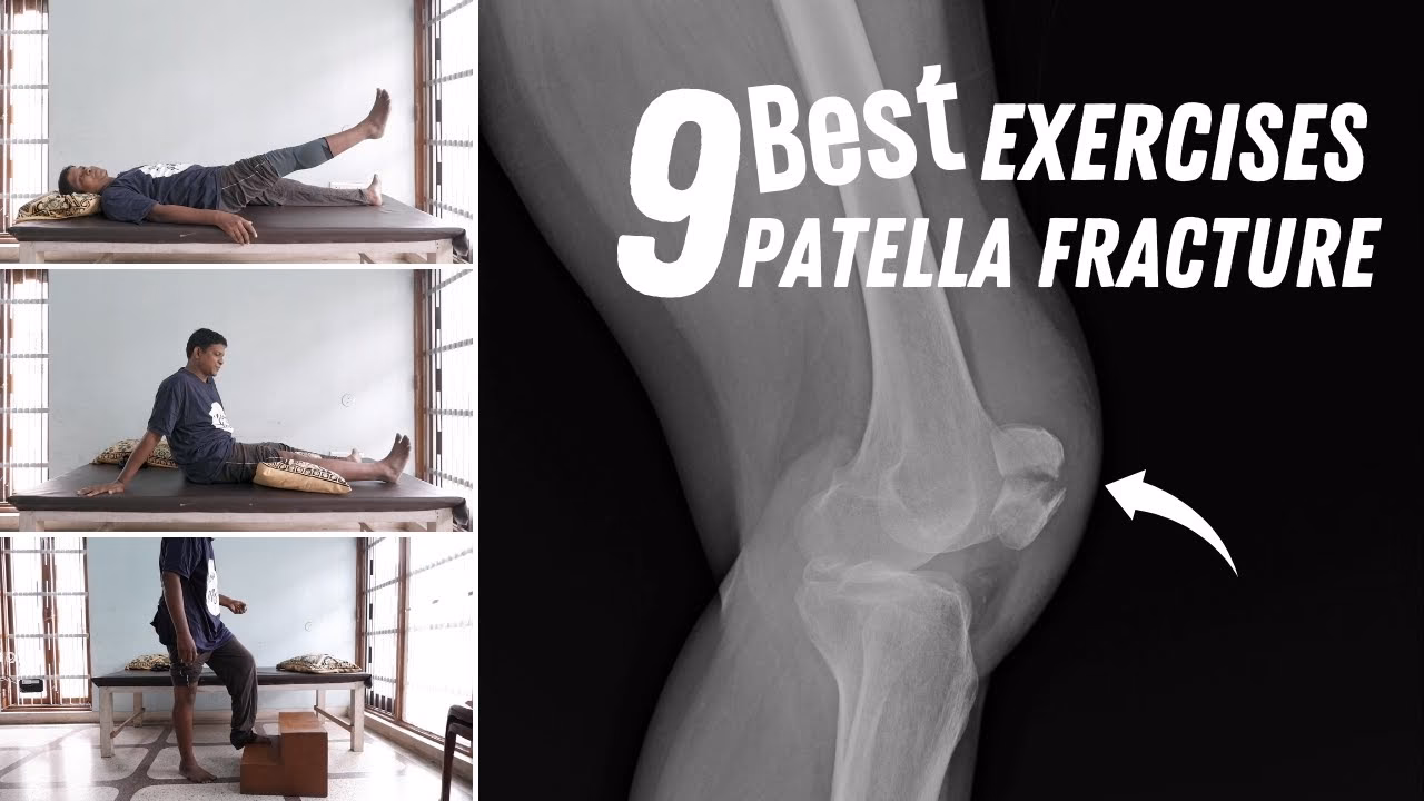 How to reduce patellofemoral problems?