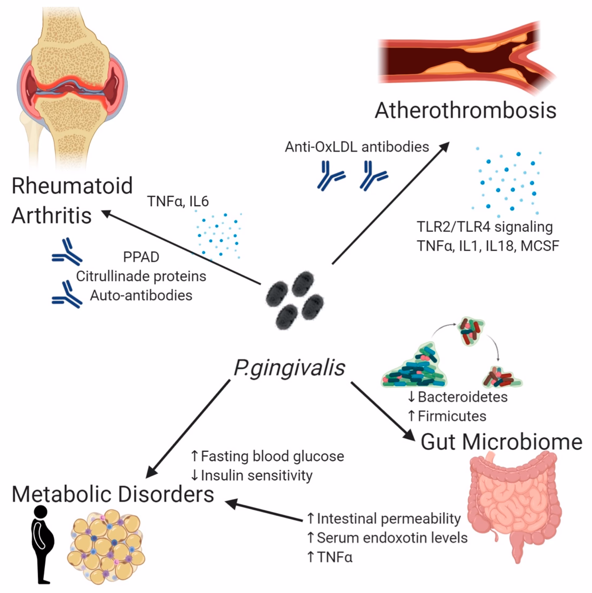 Does Porphyromonas gingivalis cause rheumatoid arthritis?