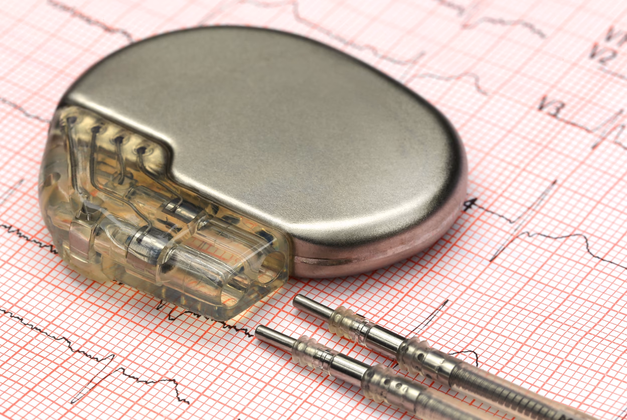 How much does a pacemaker cost?