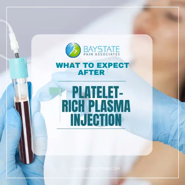What should I expect after a PRP procedure?