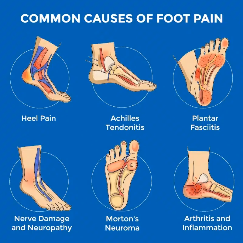What is foot pain?