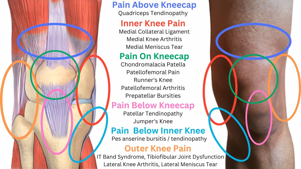 Why does my plica hurt under my knee?