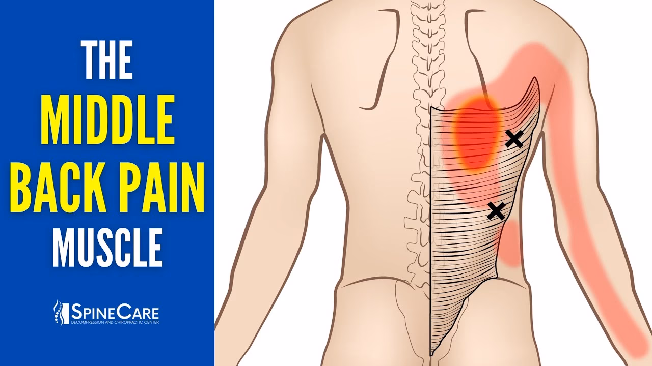 What does sudden sharp pain in the middle of the back feel like?