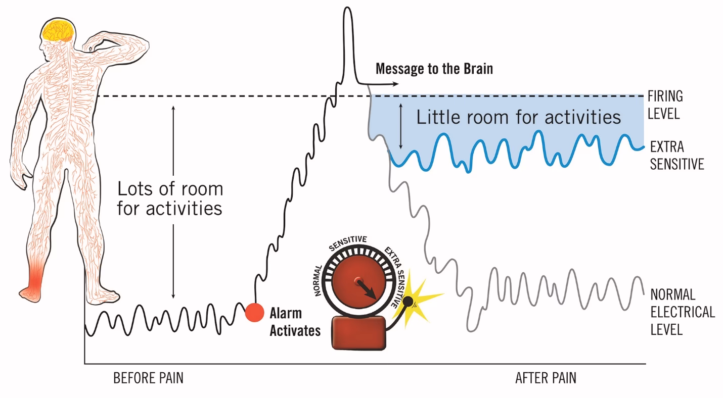 Is pain associated with neurological disease subjective?