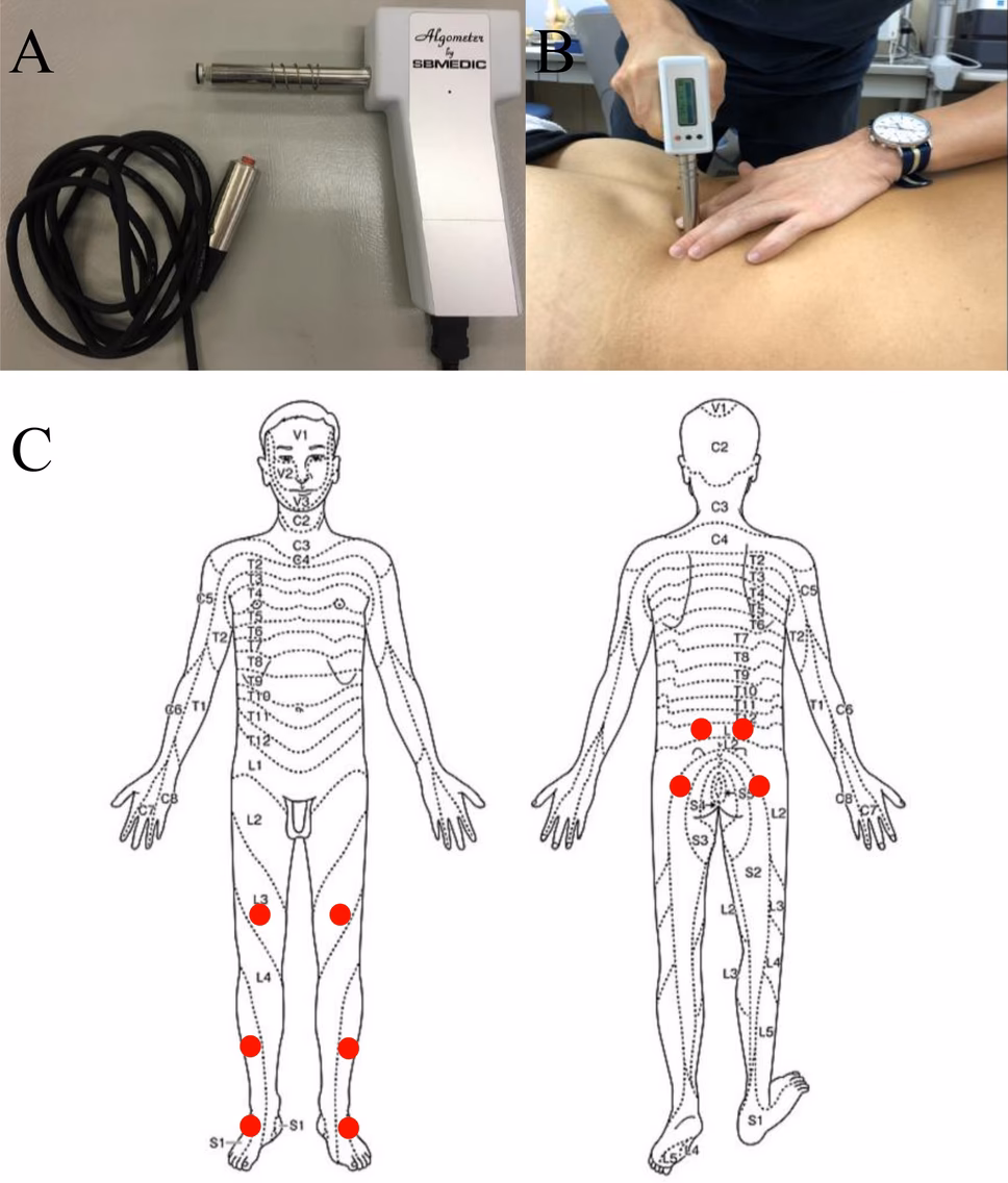 What is a pain threshold?