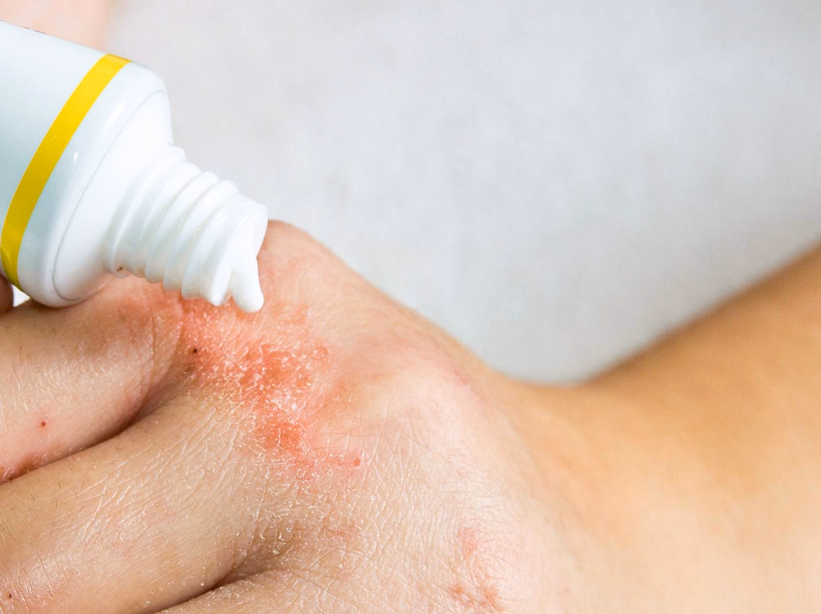 Wie wirkt sich Paraben auf die Haut aus?