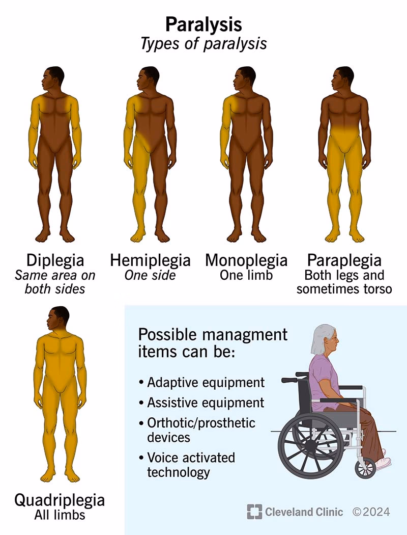 What medicines are used to treat paralysis?