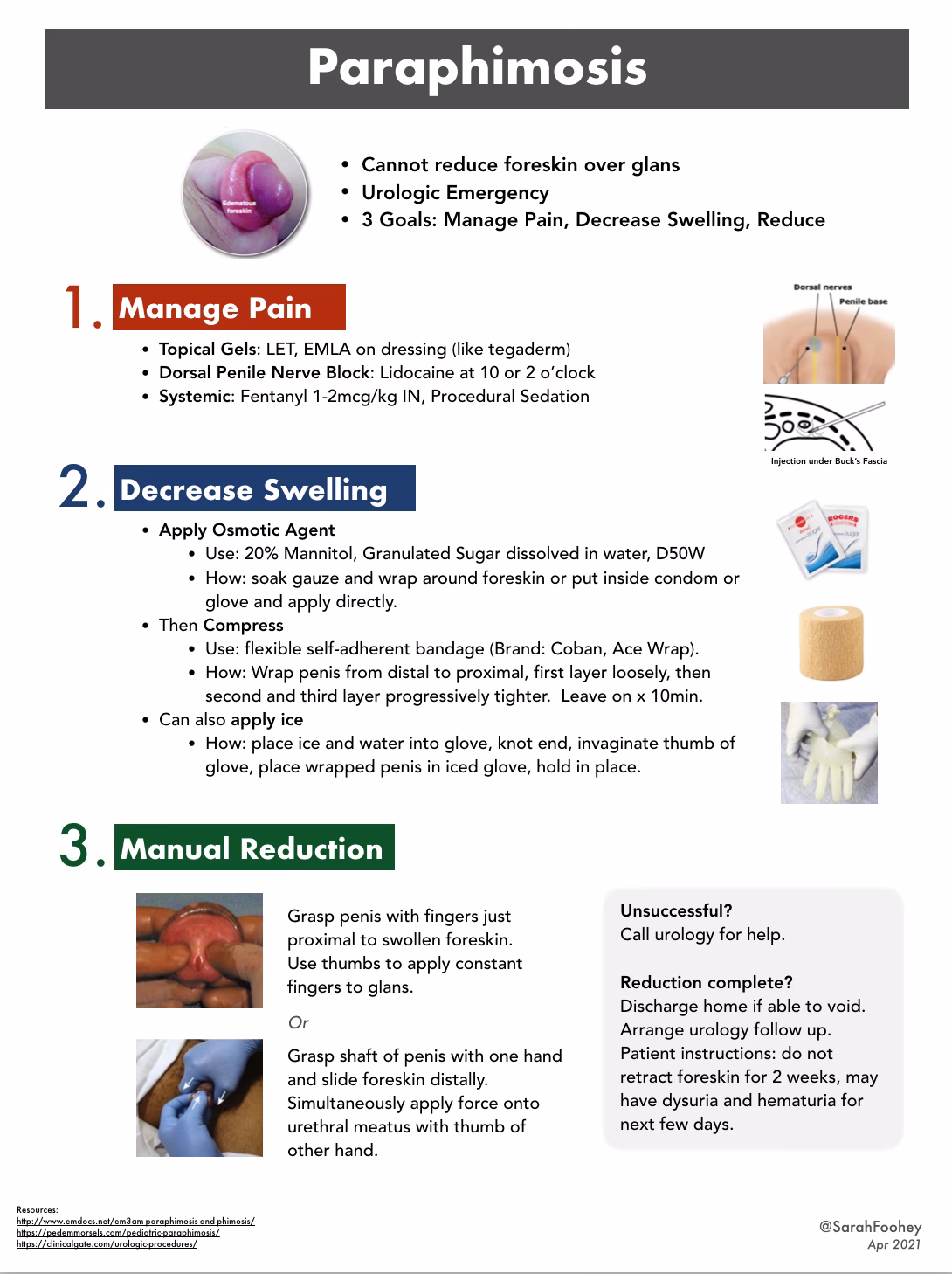 What causes paraphimosis?