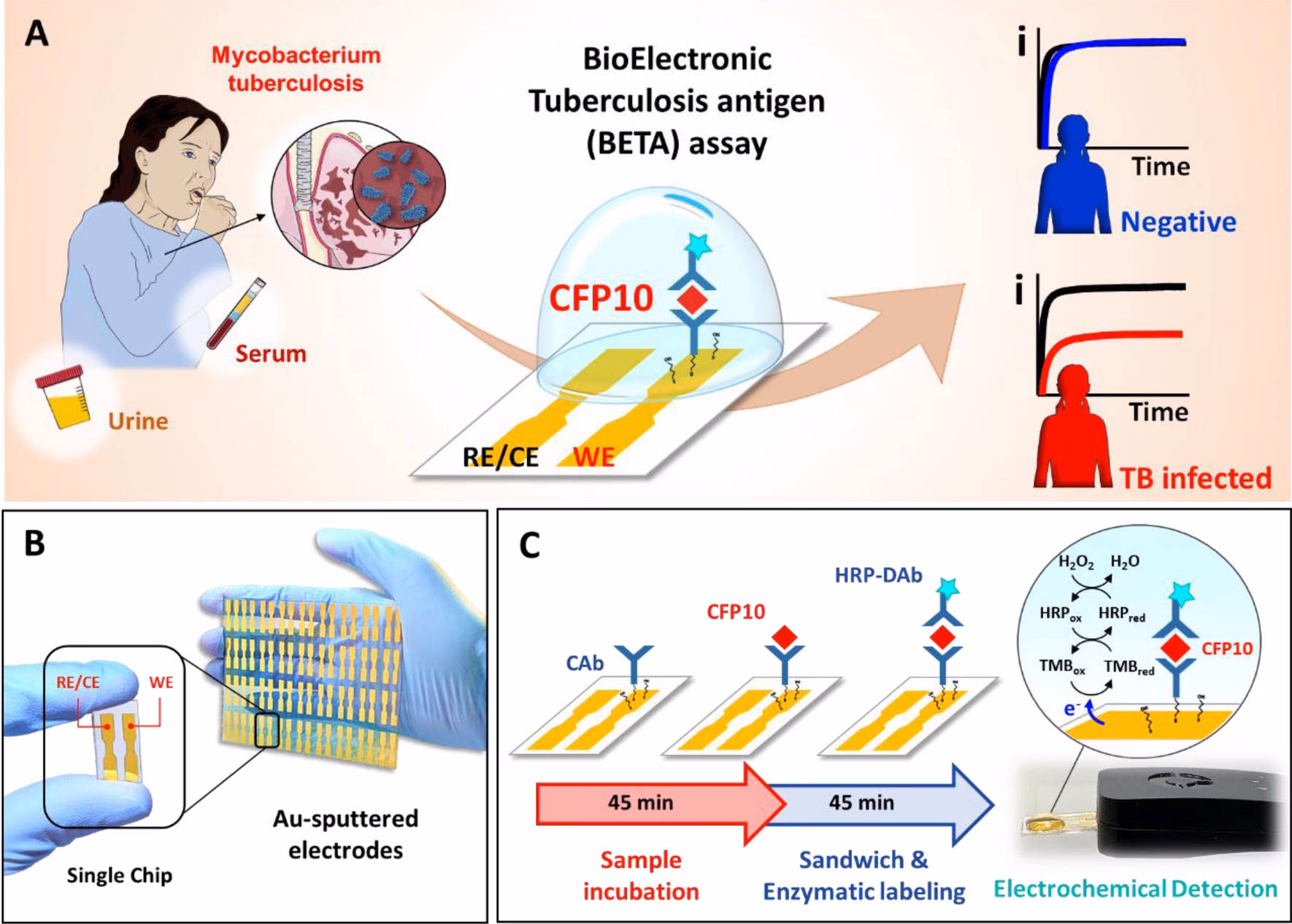 What is the predictive value of serum PCT for tuberculous pulmonary disease?