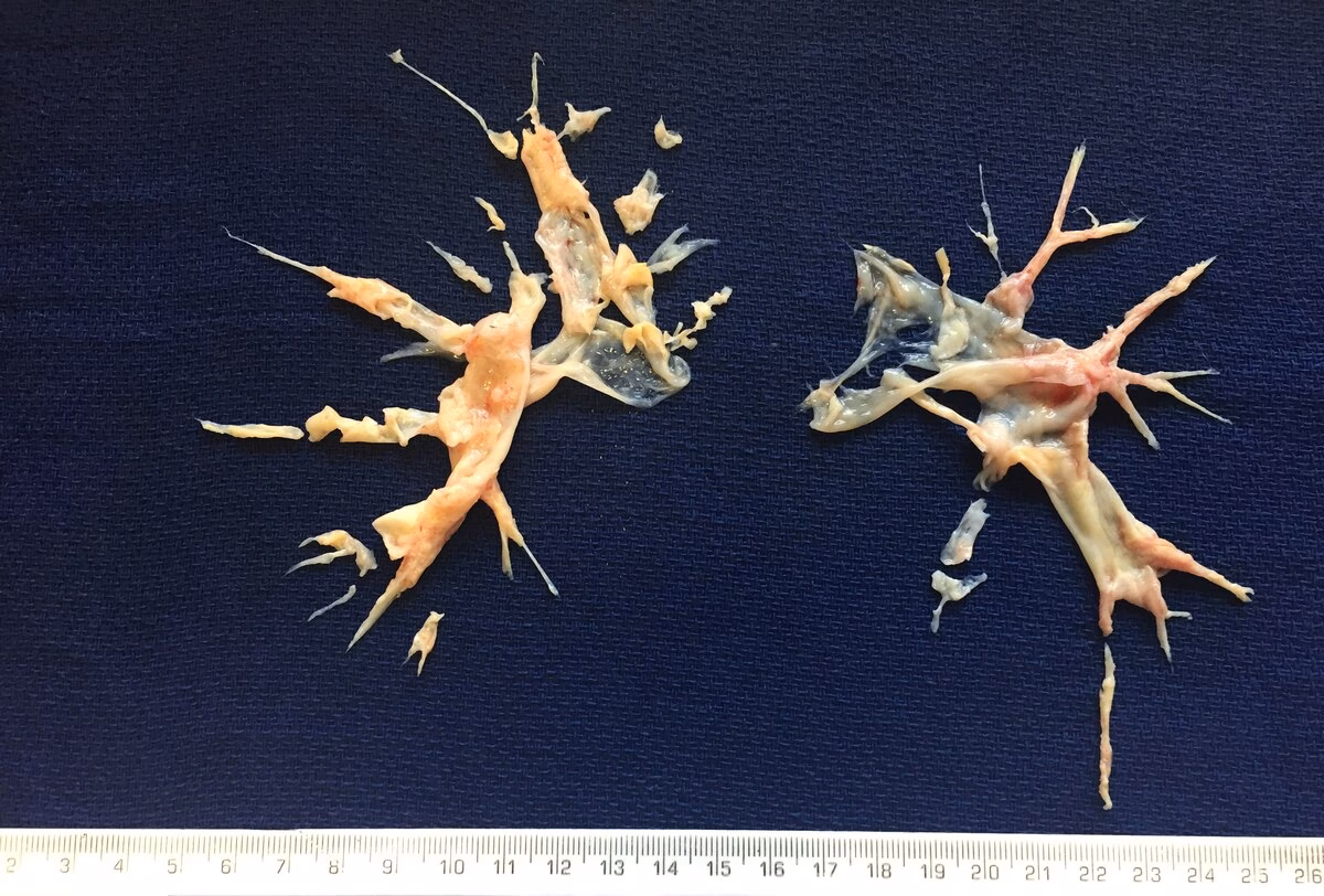 What is a PTE & how does it work?