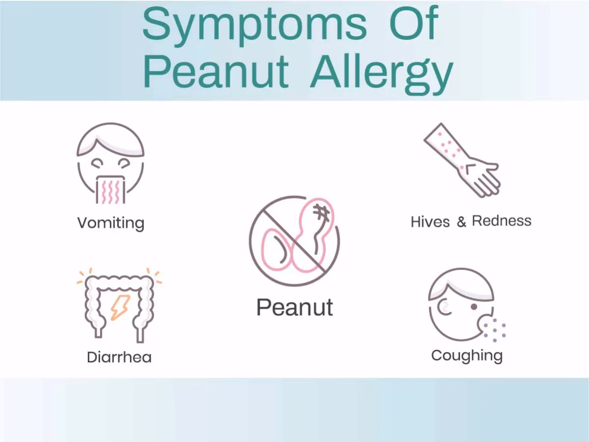 What happens if you are allergic to peanuts?