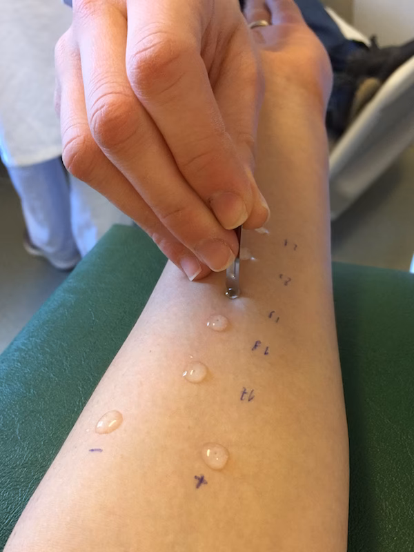 What is a peanut component allergy test?