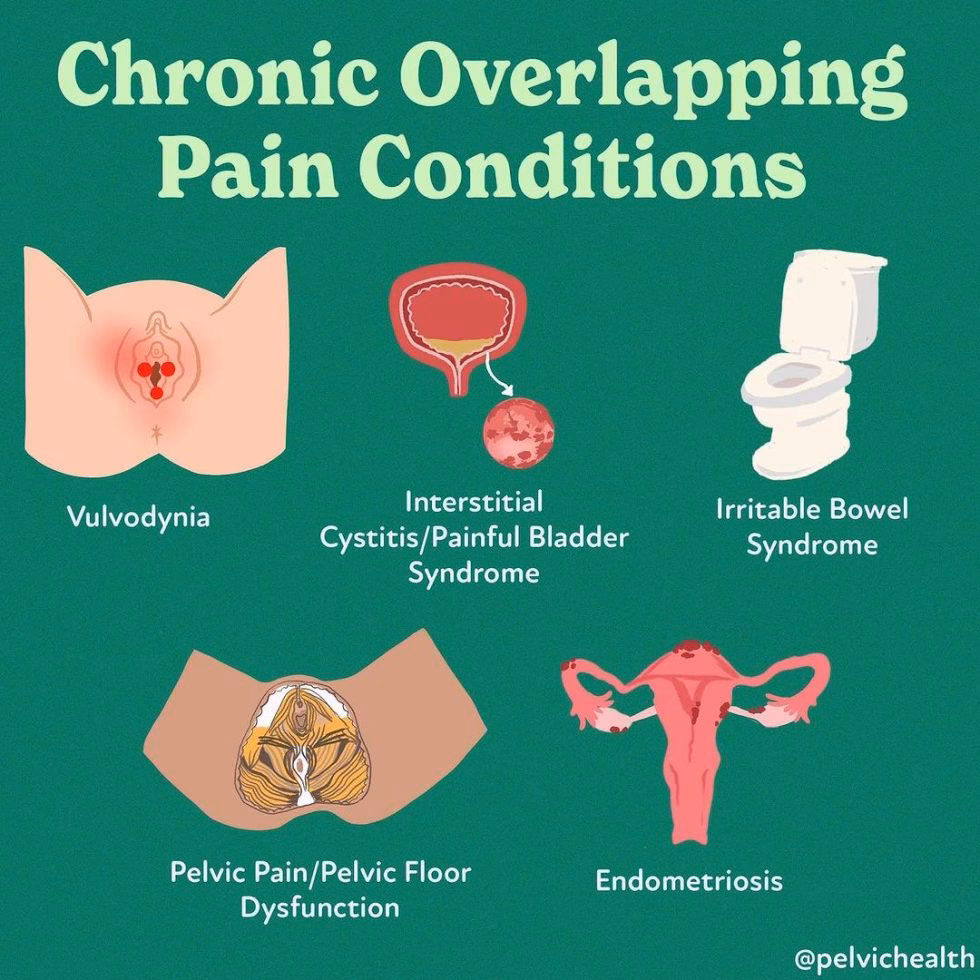 What is pelvic pain & how is it treated?