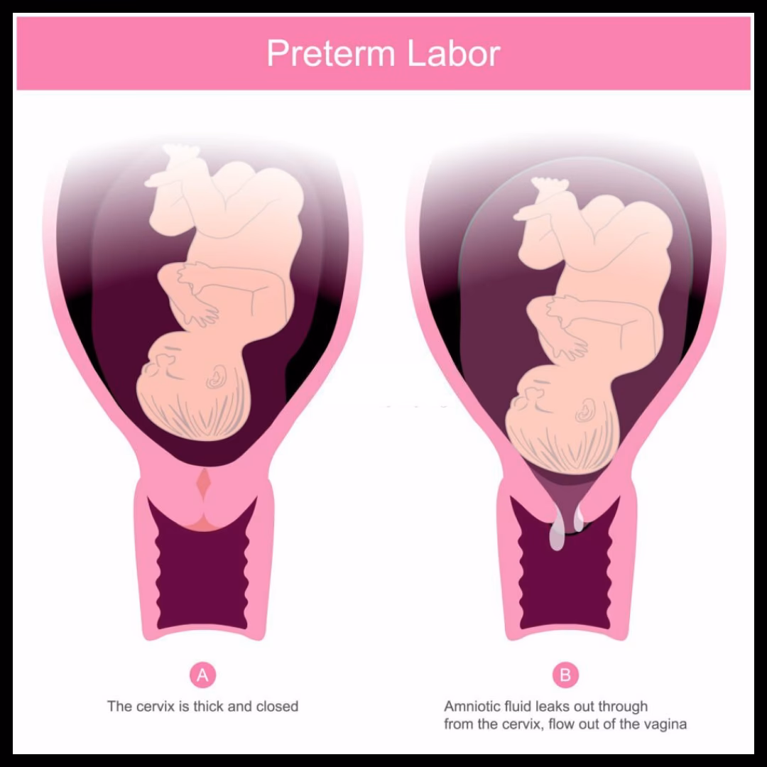 Why do unborn babies descend into the pelvis?