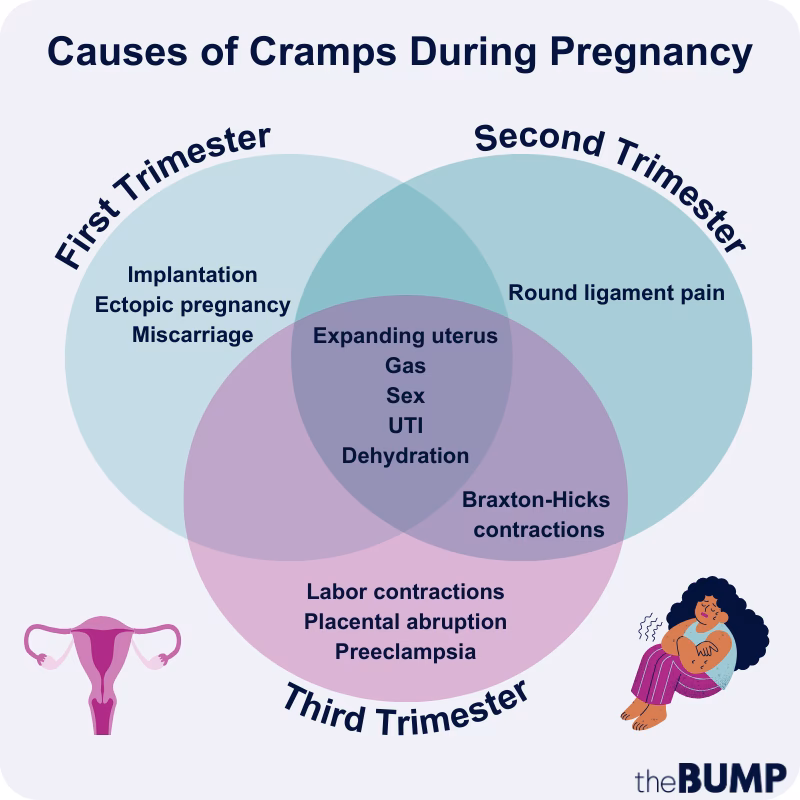 Do early labor pains feel like menstrual cramps?