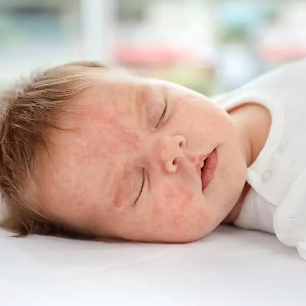 Are phadiatop tests positive in patients with allergic disease?