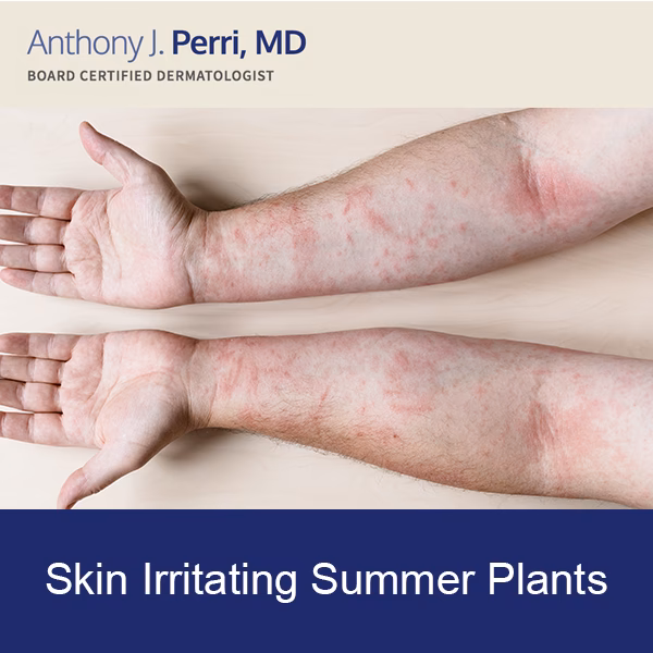 What plants cause rashes & rash?