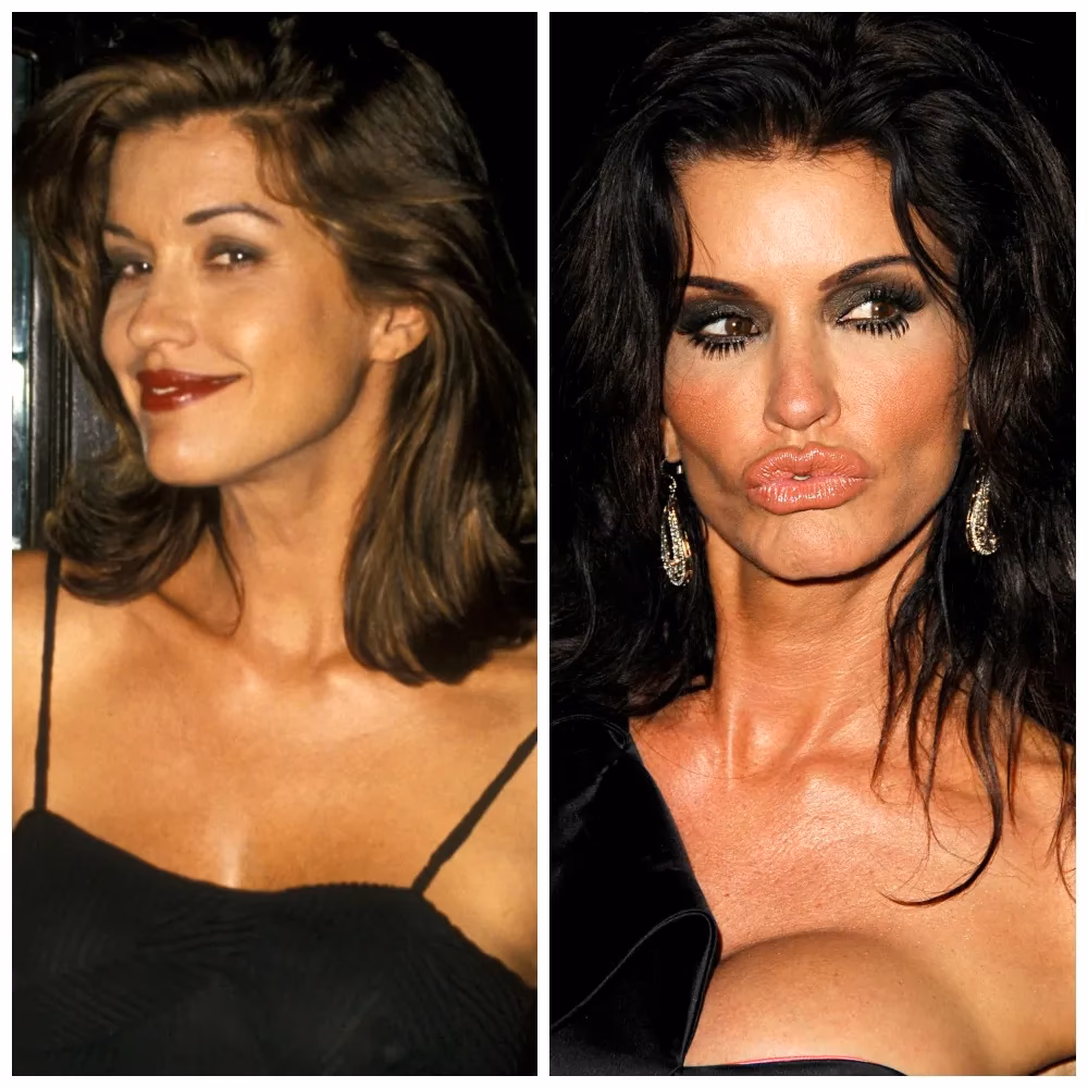 Does celebrity plastic surgery always turn out the way people want it?