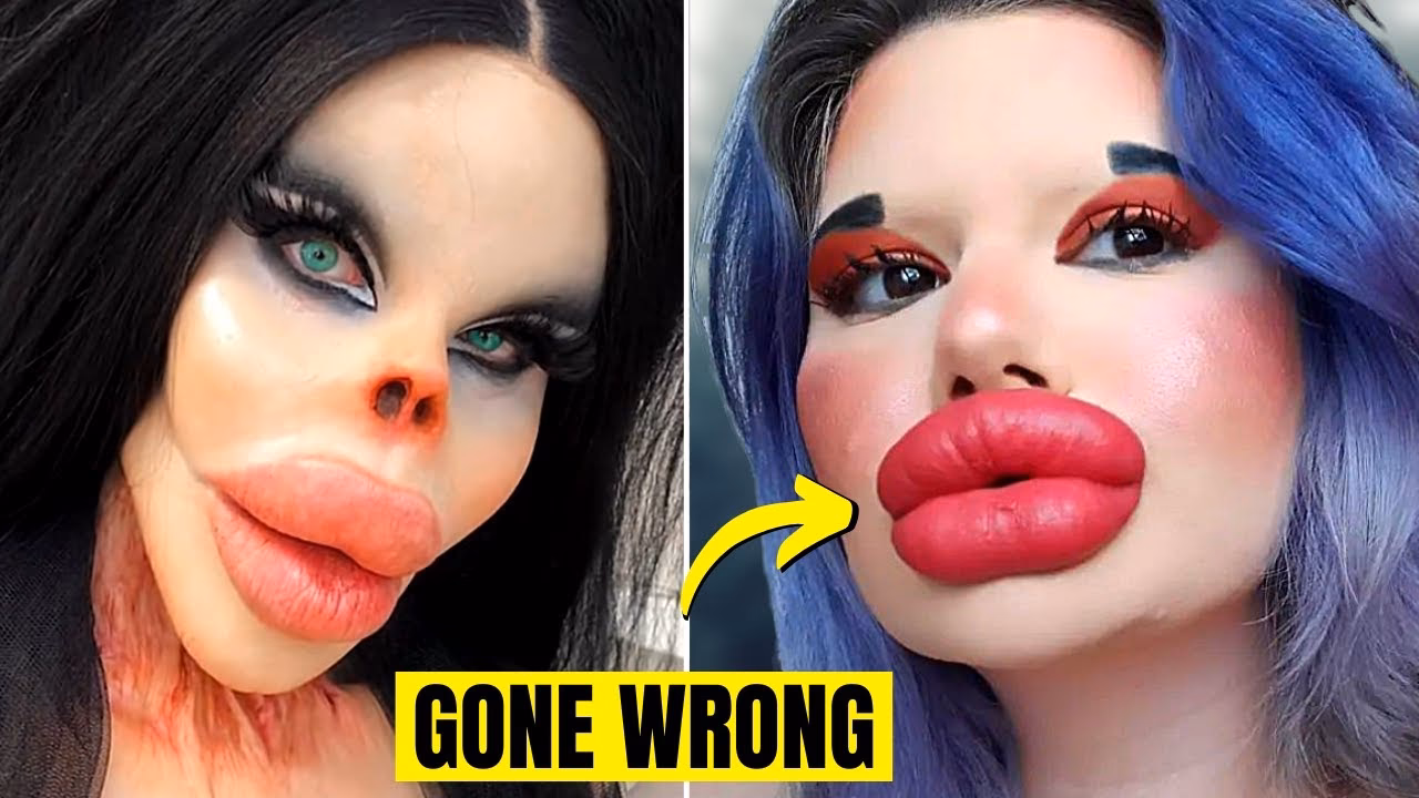 Did celebrity Plastic Surgery Disasters go wrong with before after photos?