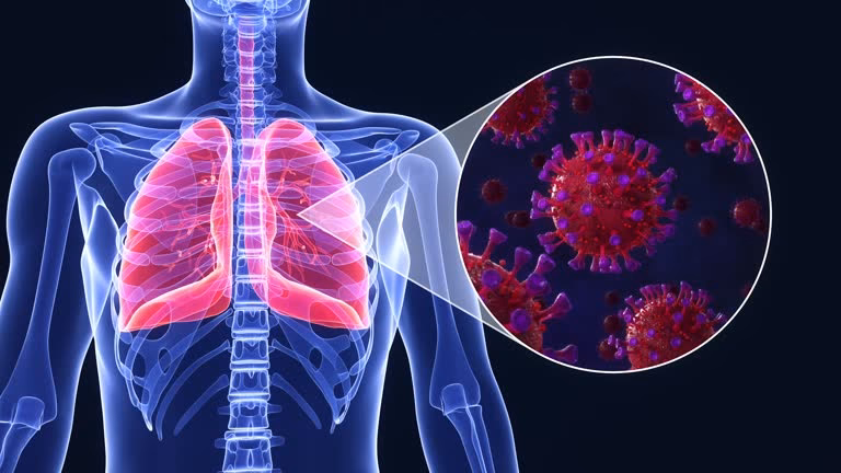 Are pneumonia animations royalty-free?