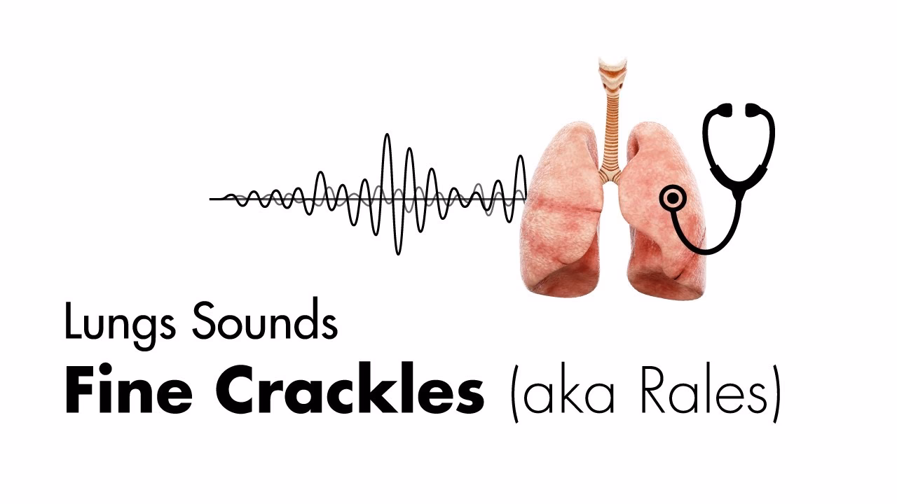 What sounds do pneumonia lungs make?
