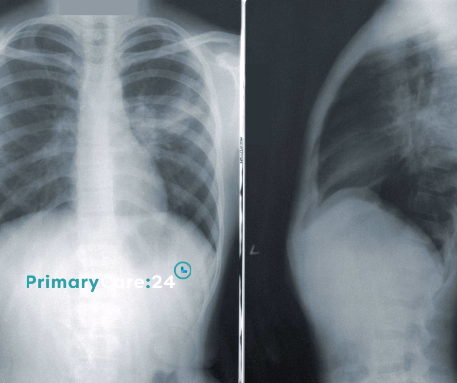 Who is at risk for pneumonia?