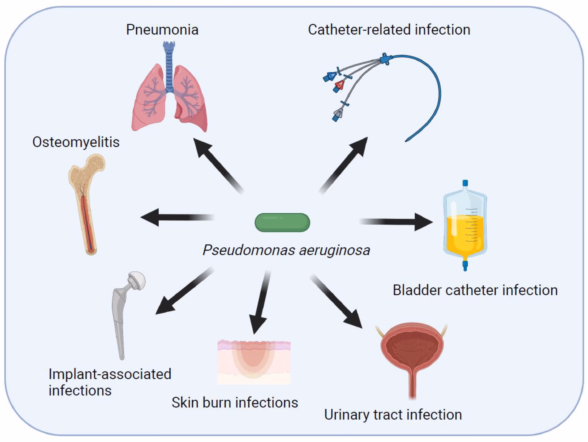 Is P aeruginosa a common cause of nosocomial infections?
