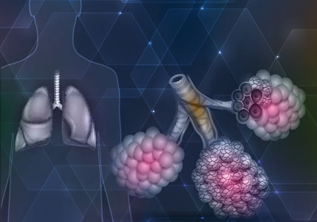 Como tratar pneumonite química?