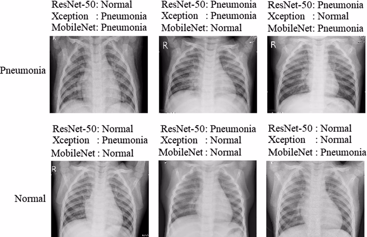 Is a chest radiograph a 'gold standard' for pneumonia in children?