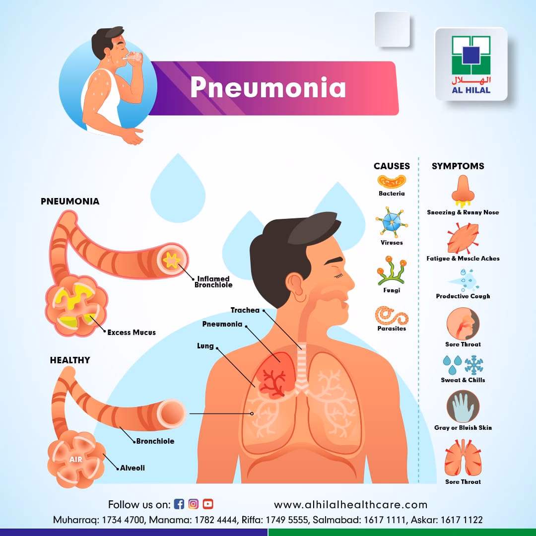 What causes pneumonia in teens?
