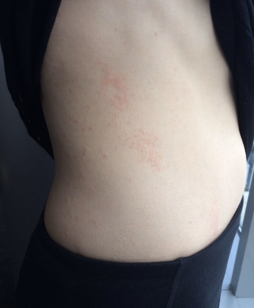 Do you have airborne allergies?