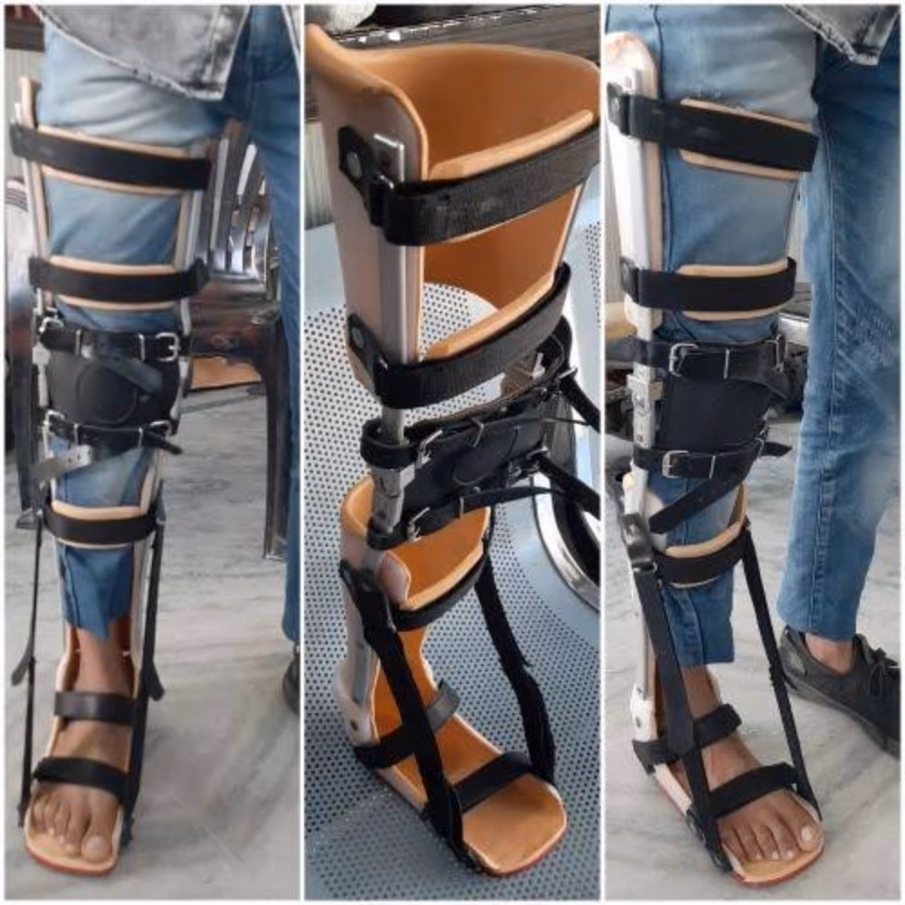 What types of calipers are made from polypropylene?