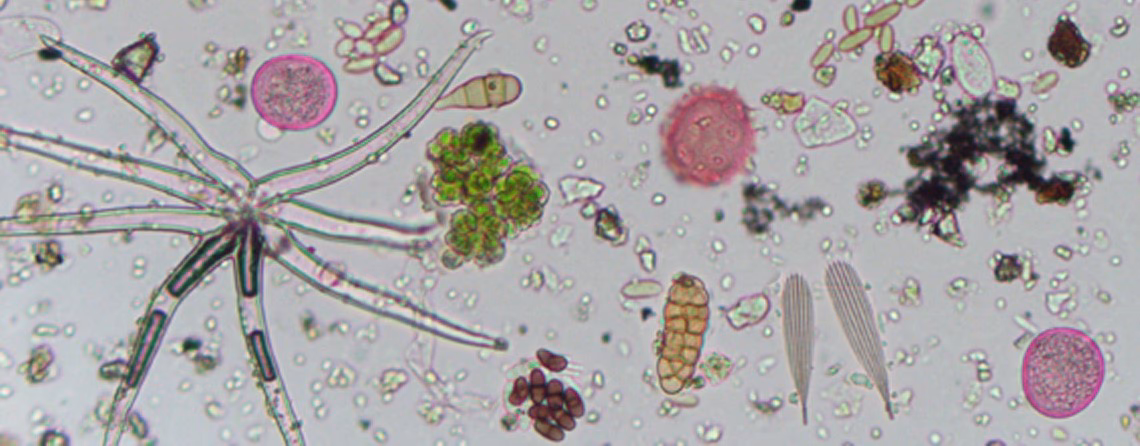 Are pollen grains a pollen allergen?