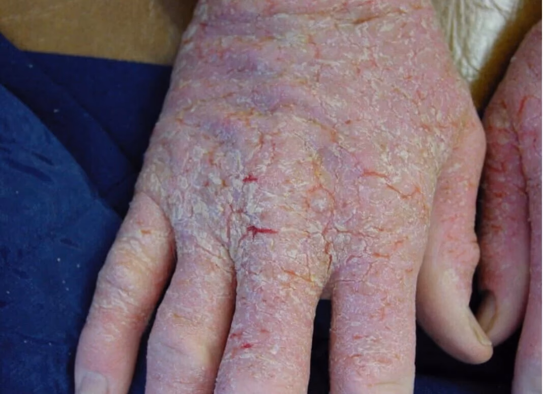 Where is potassium dichromate found?