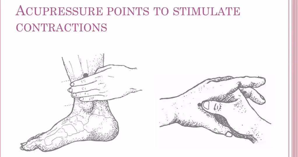 How to induce labor with pressure points?
