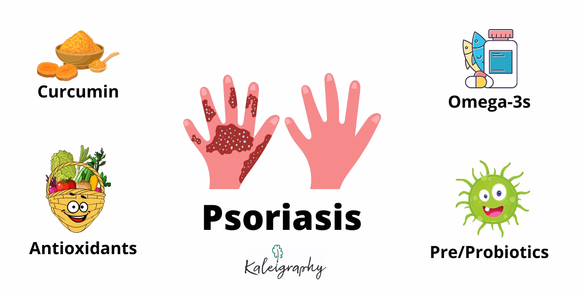 Can eating affect psoriasis?